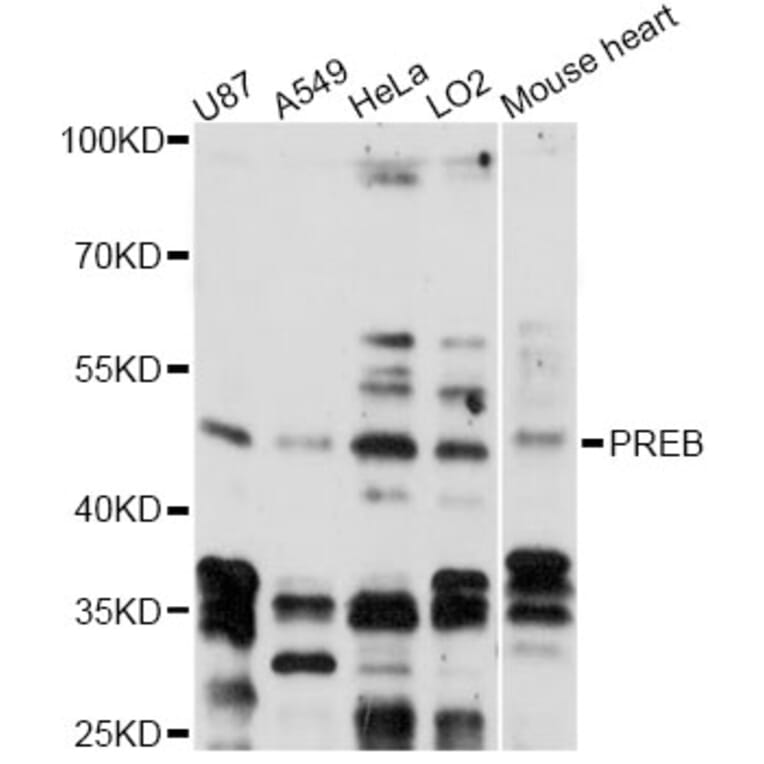 Western Blot - Anti-PREB Antibody (A14347) - Antibodies.com