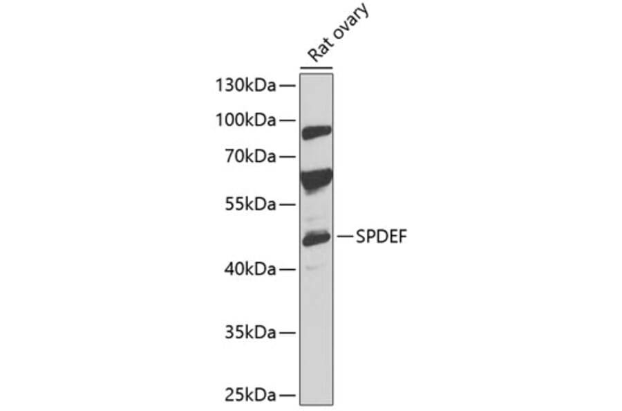 Western Blot - Anti-SPDEF/PSE Antibody (A90229) - Antibodies.com