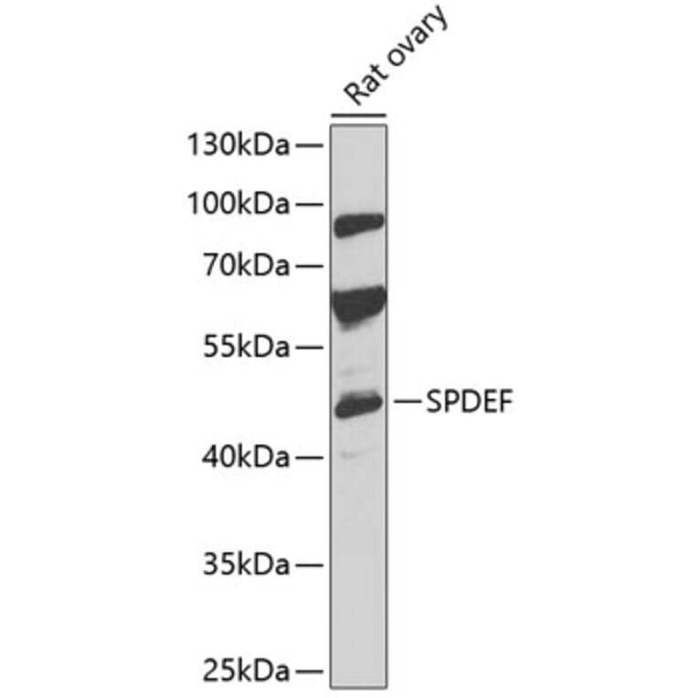 Western Blot - Anti-SPDEF/PSE Antibody (A90229) - Antibodies.com