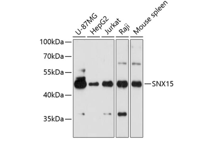 Western Blot - Anti-SNX15 Antibody (A90230) - Antibodies.com