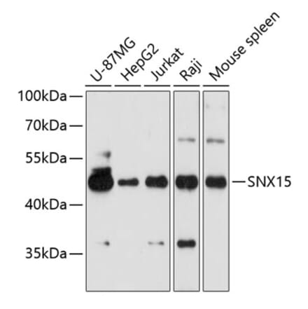 Western Blot - Anti-SNX15 Antibody (A90230) - Antibodies.com