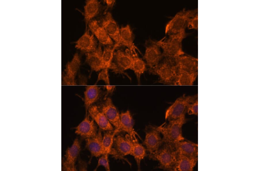 Immunofluorescence - Anti-SNX15 Antibody (A90230) - Antibodies.com