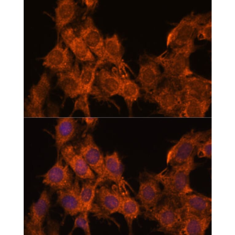 Immunofluorescence - Anti-SNX15 Antibody (A90230) - Antibodies.com