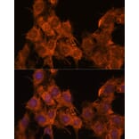 Immunofluorescence - Anti-SNX15 Antibody (A90230) - Antibodies.com
