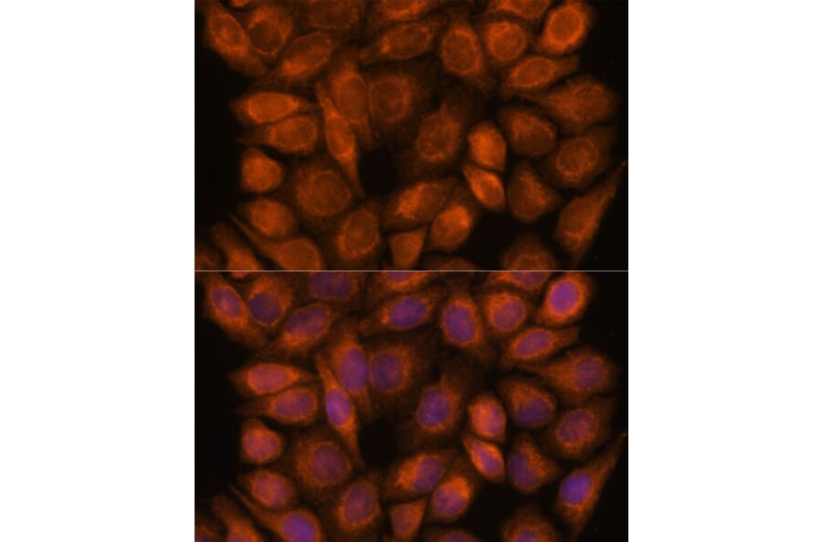 Immunofluorescence - Anti-SNX15 Antibody (A90230) - Antibodies.com