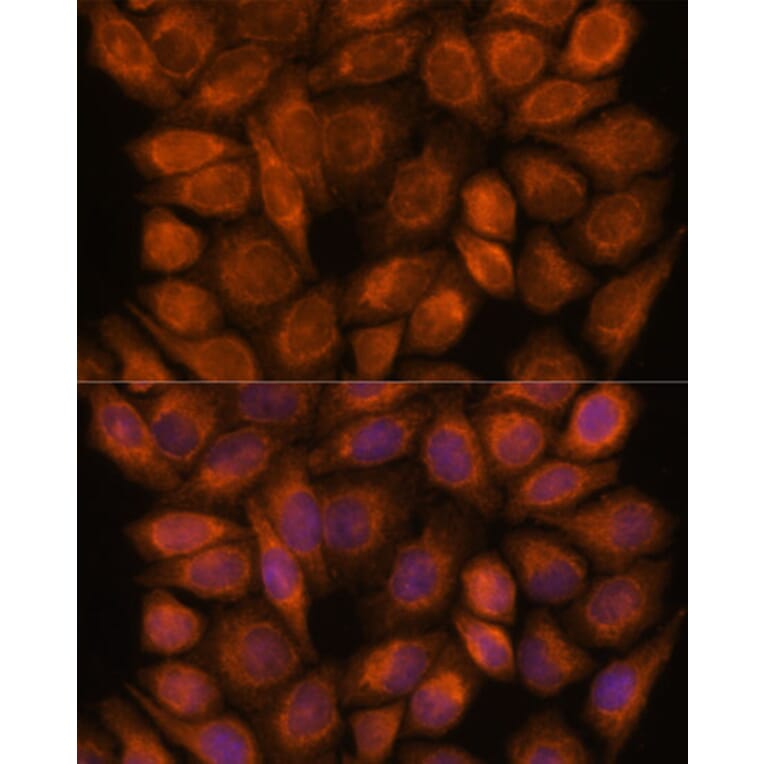 Immunofluorescence - Anti-SNX15 Antibody (A90230) - Antibodies.com