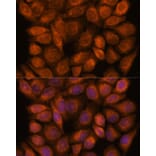 Immunofluorescence - Anti-SNX15 Antibody (A90230) - Antibodies.com