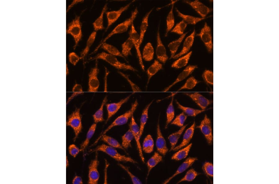 Immunofluorescence - Anti-SNX15 Antibody (A90230) - Antibodies.com