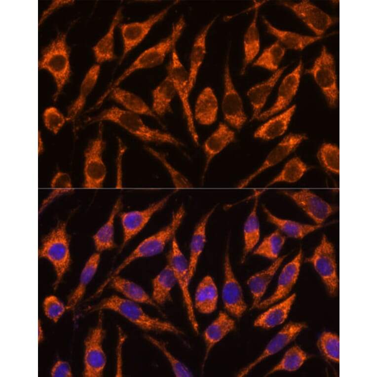 Immunofluorescence - Anti-SNX15 Antibody (A90230) - Antibodies.com