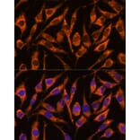 Immunofluorescence - Anti-SNX15 Antibody (A90230) - Antibodies.com