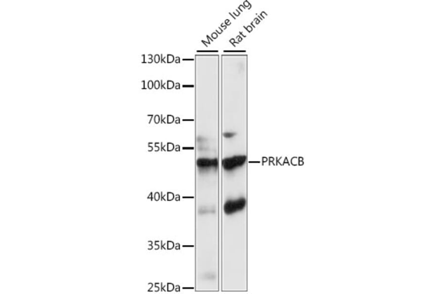 Western Blot - Anti-PKA beta Antibody (A90232) - Antibodies.com