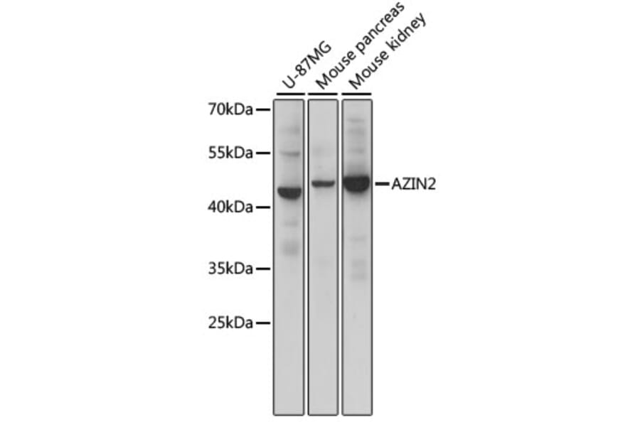 Western Blot - Anti-AZIN2 Antibody (A90233) - Antibodies.com