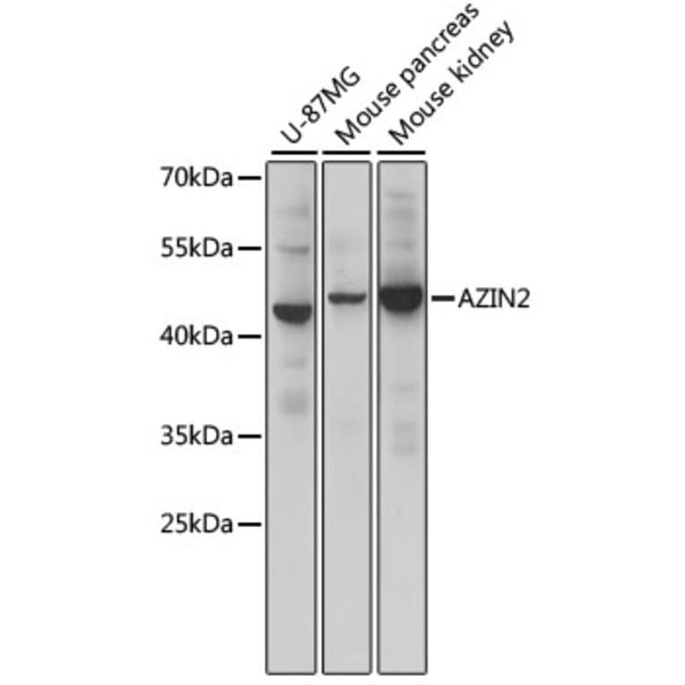 Western Blot - Anti-AZIN2 Antibody (A90233) - Antibodies.com