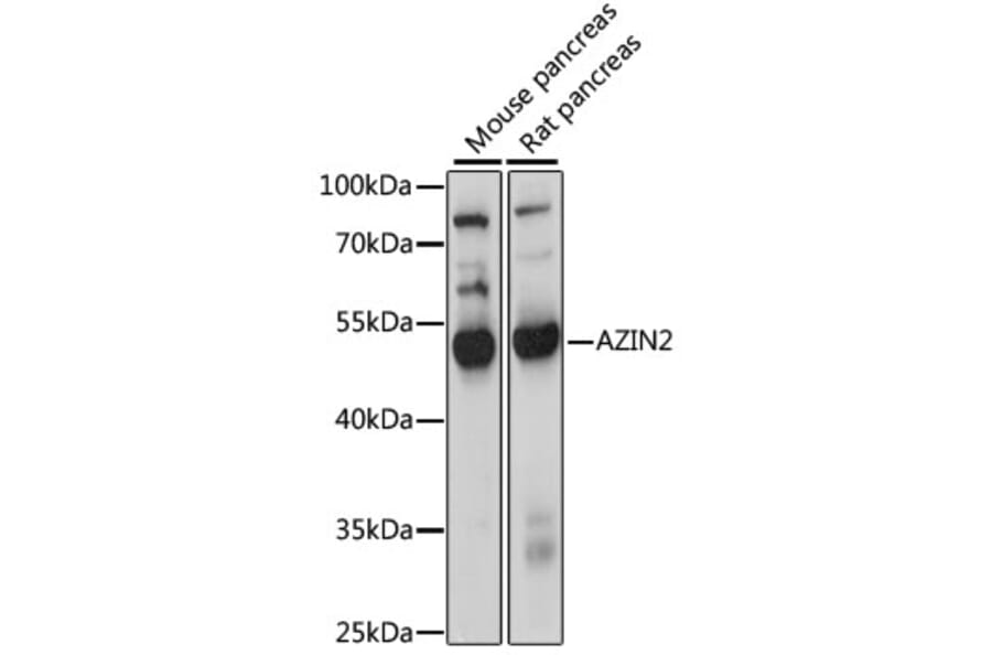Western Blot - Anti-AZIN2 Antibody (A90234) - Antibodies.com