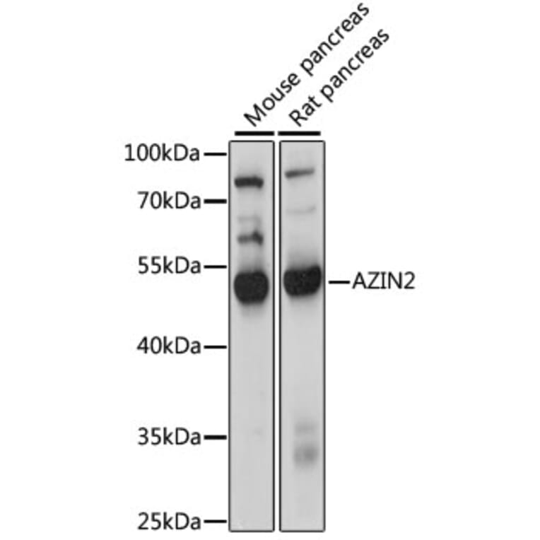 Western Blot - Anti-AZIN2 Antibody (A90234) - Antibodies.com