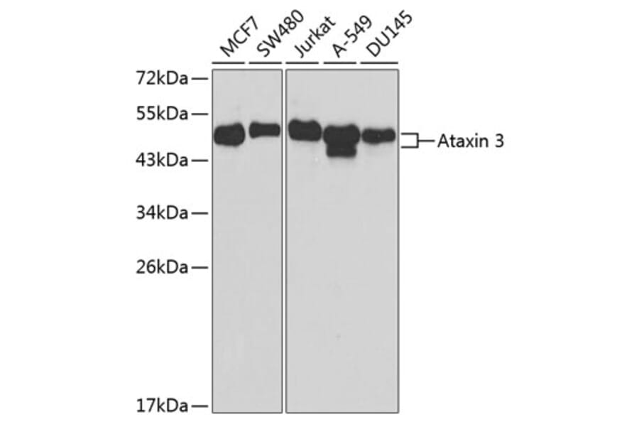 Western Blot - Anti-Ataxin 3 Antibody (A90236) - Antibodies.com
