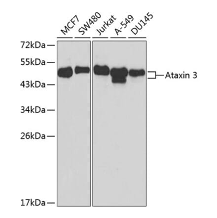 Western Blot - Anti-Ataxin 3 Antibody (A90236) - Antibodies.com