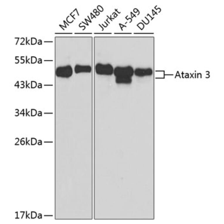 Western Blot - Anti-Ataxin 3 Antibody (A90236) - Antibodies.com