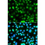 Immunofluorescence - Anti-Ataxin 3 Antibody (A90236) - Antibodies.com