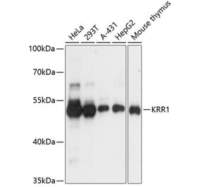 Western Blot - Anti-KRR1 Antibody (A90239) - Antibodies.com