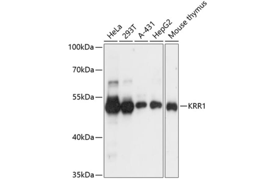 Western Blot - Anti-KRR1 Antibody (A90239) - Antibodies.com