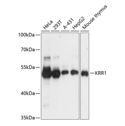 Western Blot - Anti-KRR1 Antibody (A90239) - Antibodies.com