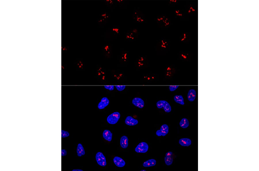 Immunofluorescence - Anti-KRR1 Antibody (A90239) - Antibodies.com