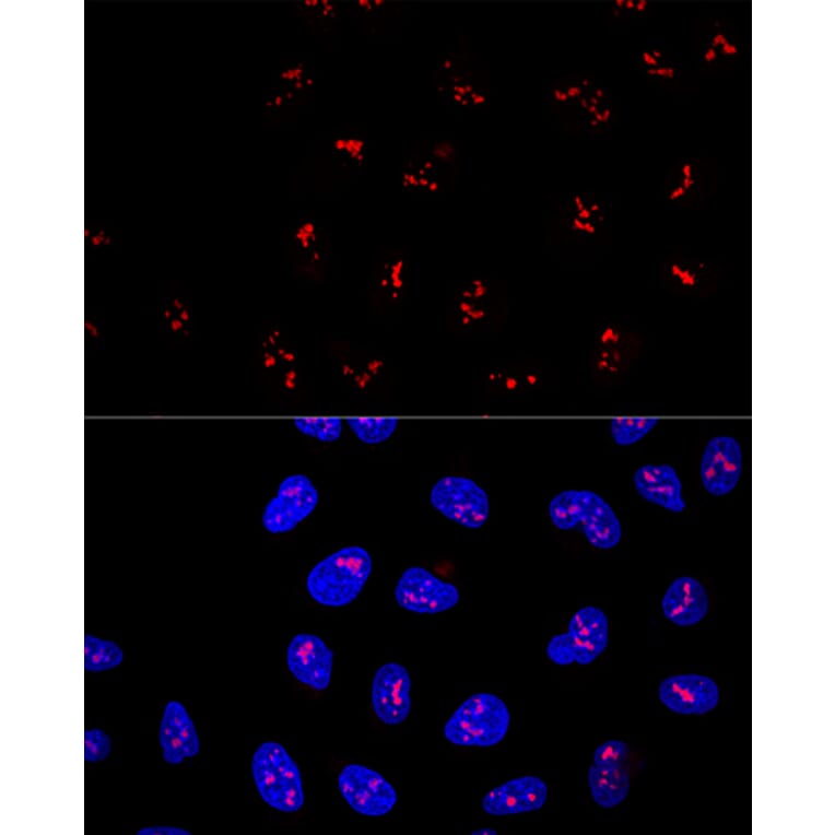 Immunofluorescence - Anti-KRR1 Antibody (A90239) - Antibodies.com
