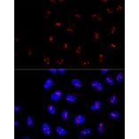 Immunofluorescence - Anti-KRR1 Antibody (A90239) - Antibodies.com