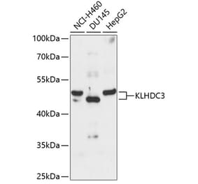 Western Blot - Anti-KLHDC3 Antibody (A90240) - Antibodies.com