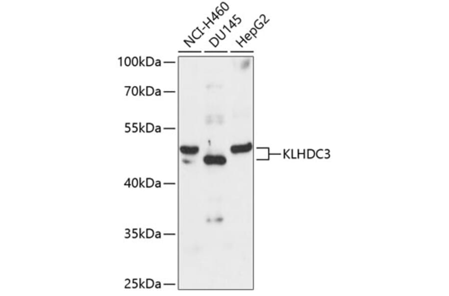 Western Blot - Anti-KLHDC3 Antibody (A90240) - Antibodies.com
