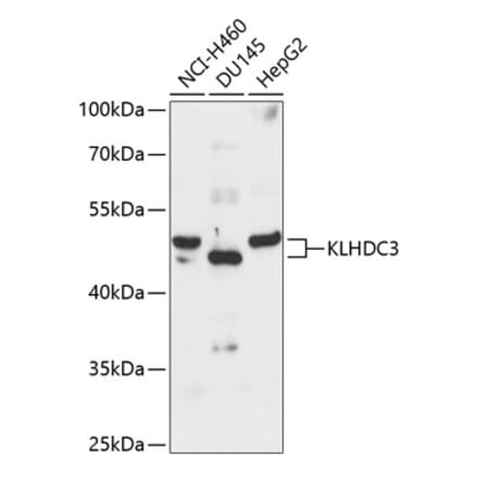 Western Blot - Anti-KLHDC3 Antibody (A90240) - Antibodies.com