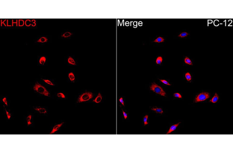Immunofluorescence - Anti-KLHDC3 Antibody (A90240) - Antibodies.com
