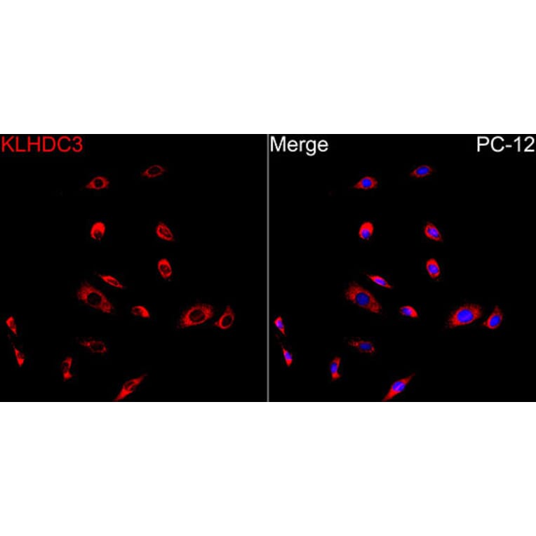 Immunofluorescence - Anti-KLHDC3 Antibody (A90240) - Antibodies.com
