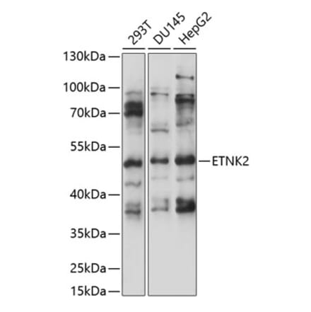 Western Blot - Anti-ETNK2 Antibody (A90241) - Antibodies.com