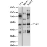 Western Blot - Anti-ETNK2 Antibody (A90241) - Antibodies.com