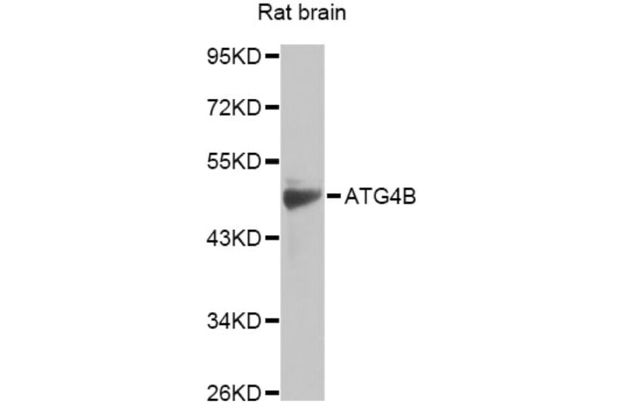 Western Blot - Anti-ATG4B Antibody (A14112) - Antibodies.com