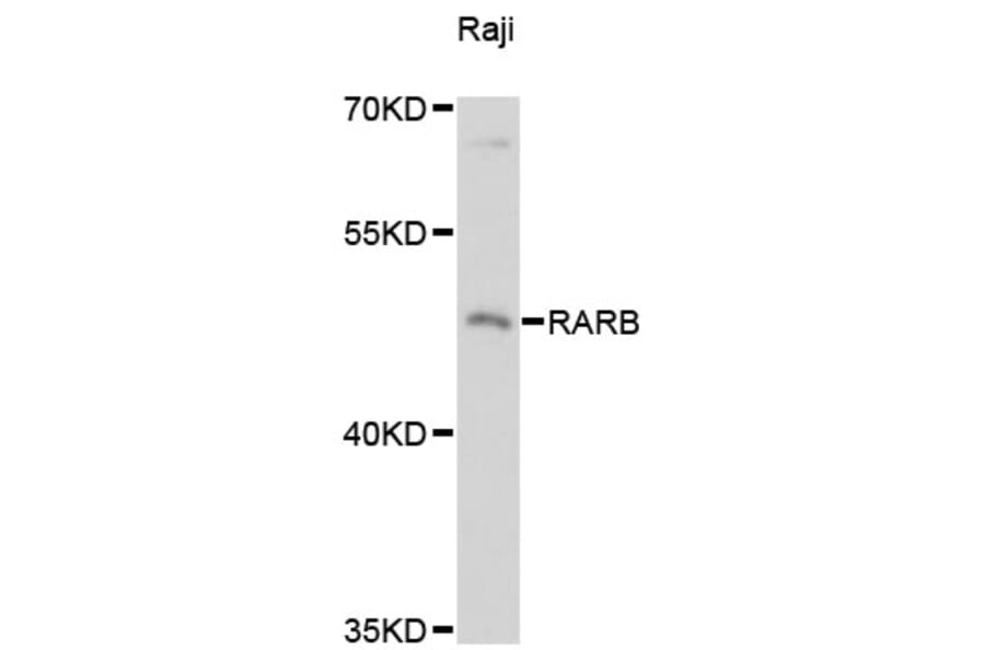 Western Blot - Anti-RARB Antibody (A13173) - Antibodies.com