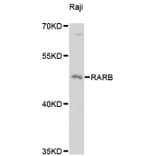Western Blot - Anti-RARB Antibody (A13173) - Antibodies.com