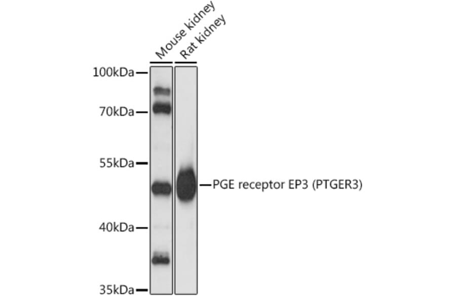 Western Blot - Anti-PTGER3 Antibody (A90245) - Antibodies.com
