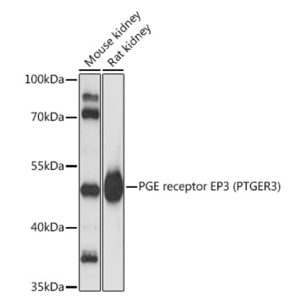 Western Blot - Anti-PTGER3 Antibody (A90245) - Antibodies.com