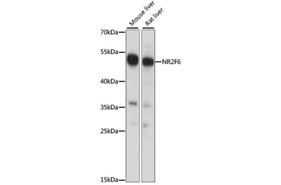 Western Blot - Anti-NR2F6/EAR-2 Antibody (A90246) - Antibodies.com