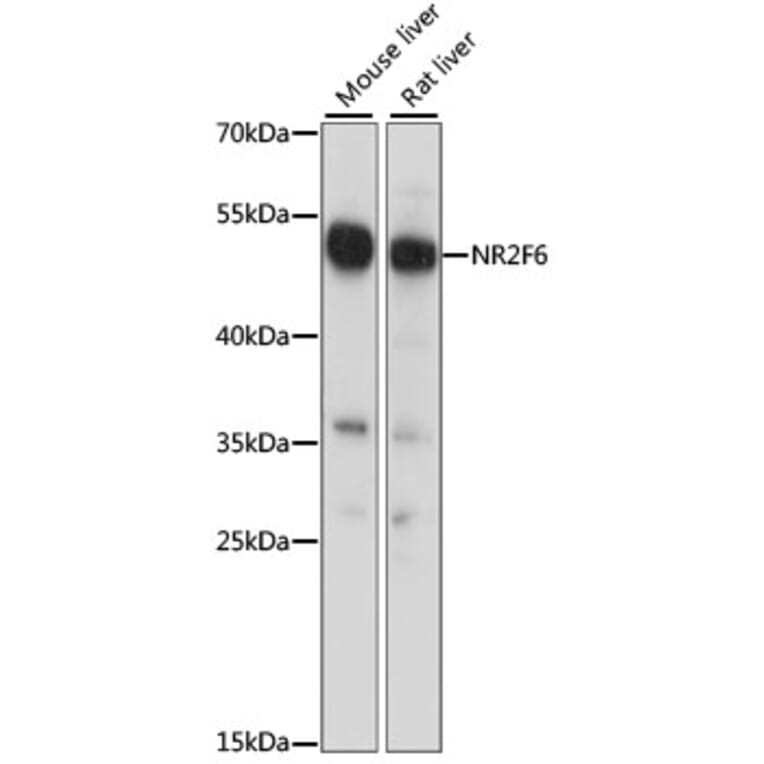 Western Blot - Anti-NR2F6/EAR-2 Antibody (A90246) - Antibodies.com