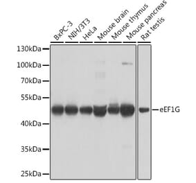 Western Blot - Anti-Elongation factor 1-gamma Antibody (A90247) - Antibodies.com