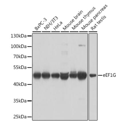 Western Blot - Anti-Elongation factor 1-gamma Antibody (A90247) - Antibodies.com