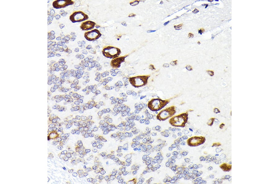 Immunohistochemistry - Anti-Elongation factor 1-gamma Antibody (A90247) - Antibodies.com
