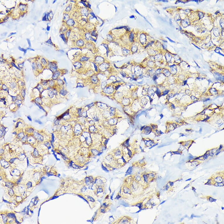 Immunohistochemistry - Anti-Elongation factor 1-gamma Antibody (A90247) - Antibodies.com