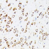 Immunohistochemistry - Anti-Elongation factor 1-gamma Antibody (A90247) - Antibodies.com