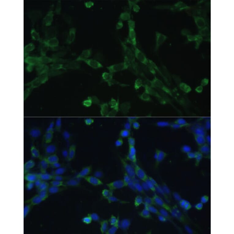 Immunofluorescence - Anti-Elongation factor 1-gamma Antibody (A90247) - Antibodies.com