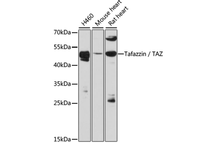 Western Blot - Anti-Tafazzin/TAZ Antibody (A90248) - Antibodies.com
